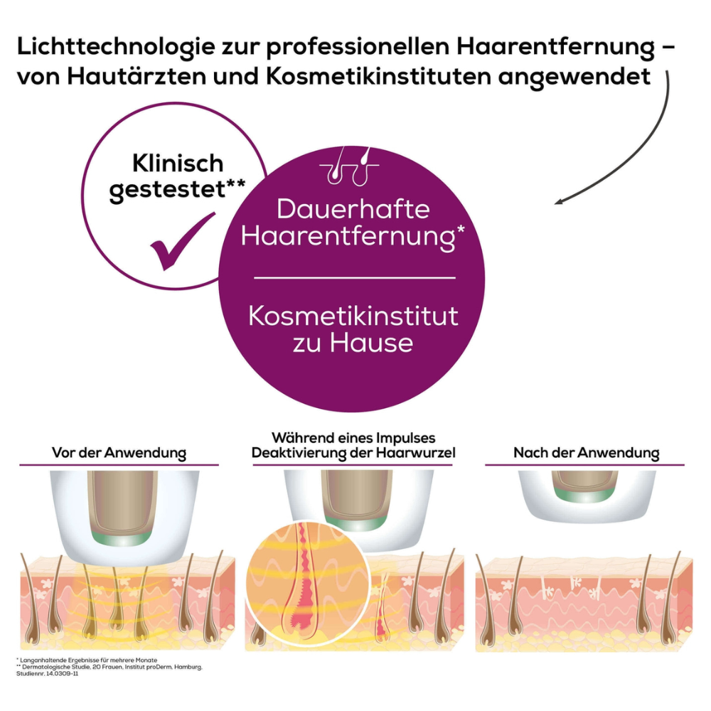Une infographie allemande sur la technologie d'épilation avec l'IPL Beurer VelvetSkinPro Black illustre le processus avant, pendant et après l'application. Le texte souligne l'épilation professionnelle définitive pour un usage domestique, testée par des dermatologues et des instituts de beauté. Les illustrations montrent l'épilation.