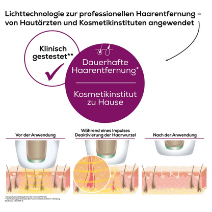 Une infographie allemande sur la technologie d'épilation avec l'IPL Beurer VelvetSkinPro Black illustre le processus avant, pendant et après l'application. Le texte souligne l'épilation professionnelle définitive pour un usage domestique, testée par des dermatologues et des instituts de beauté. Les illustrations montrent l'épilation.